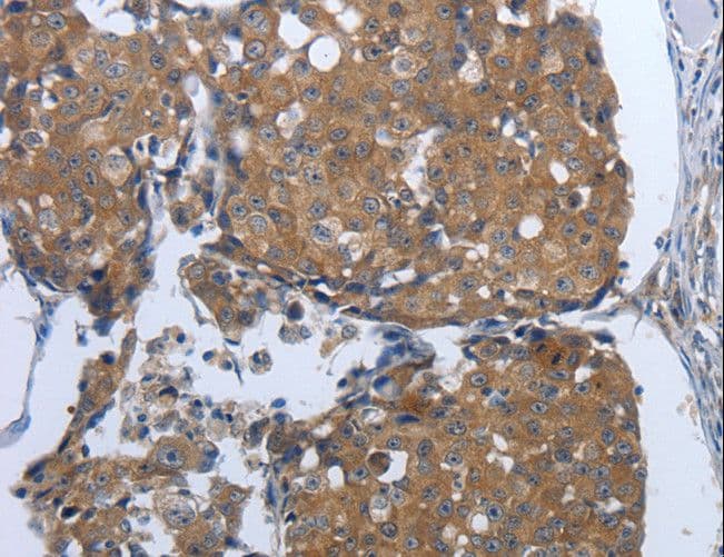 PDIA2 Antibody
