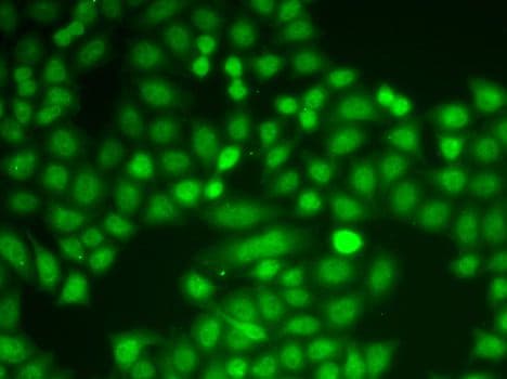 PYCARD / ASC / TMS1 Antibody