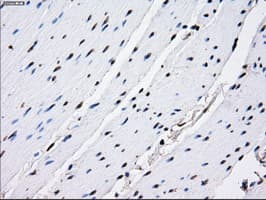 RPA2 / RFA2 / RPA34 Antibody (clone OTI8B3)