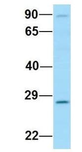 EAF2 / U19 Antibody (aa187-236)