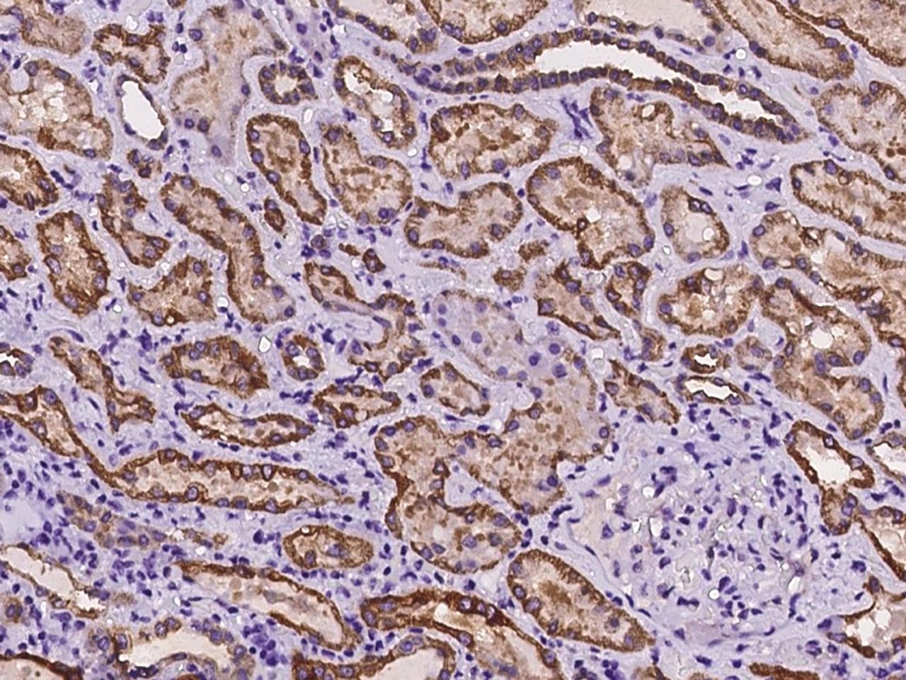 ANKRD30B Antibody