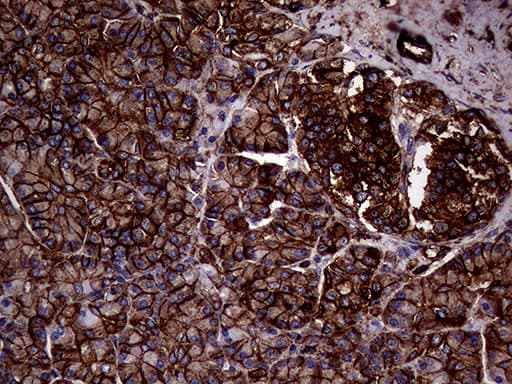 IQGAP1 Antibody (aa464-609, clone OTI6E10)