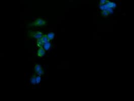 CATIP / C2orf62 Antibody (clone OTI4E1)