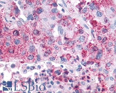 PathPlus™ Polyclonal Rabbit anti-Human FPR2 / FPRL1 Antibody (Extracellular Domain, IHC)