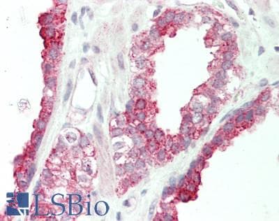 SLC39A5 / ZIP5 Antibody (N-Terminus)