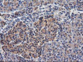 TUBAL3 Antibody (clone OTI1C2)