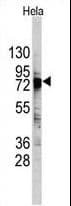 DDX3 / DDX3X Antibody (aa456-485)