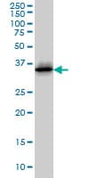 IHC-plus™ CDK6 Antibody (clone 8H4)