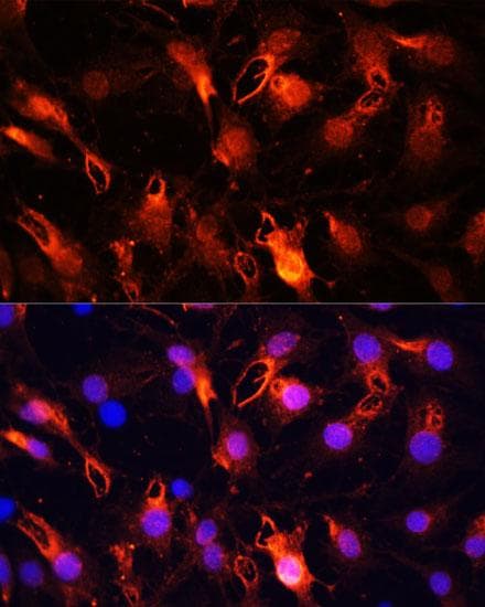 RNF149 Antibody