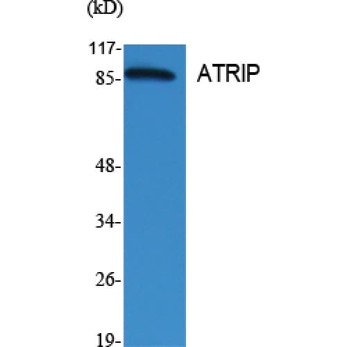 ATRIP Antibody (10-90 aa)