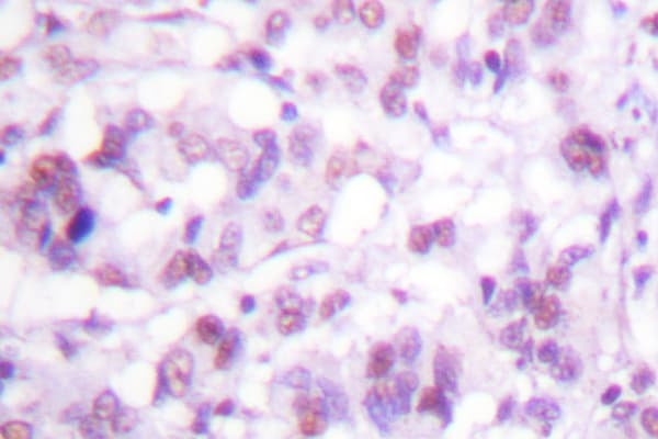 Polyclonal Rabbit anti-Human MYB / c-Myb Antibody (Arg6, IHC, IF, WB)
