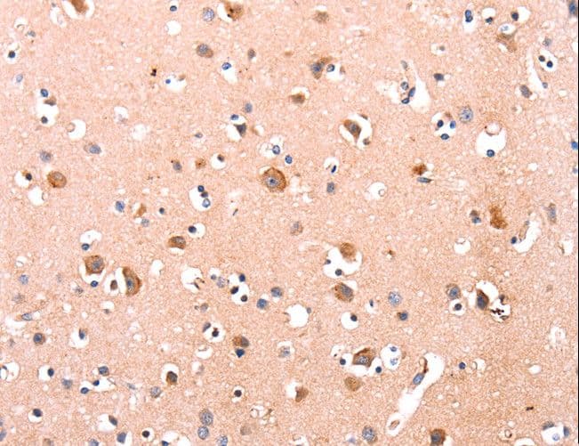 DUSP12 Antibody