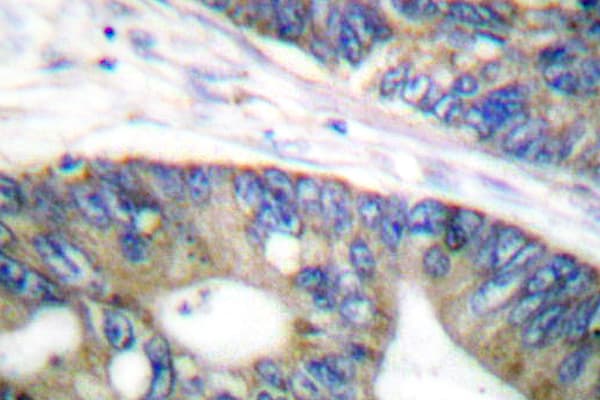EIF4EBP1 / 4EBP1 Antibody (Leu58)