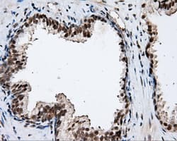 NPR3 Antibody (clone OTI11H5)