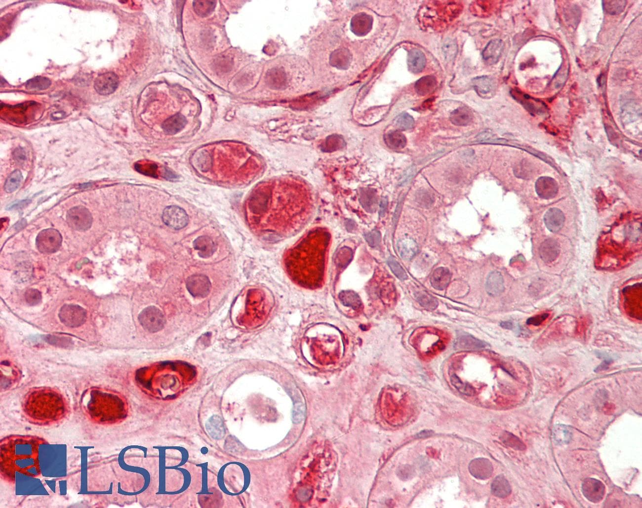 IHC-plus™ Polyclonal Sheep anti-Human F2 / Prothrombin / Thrombin Antibody (IHC)