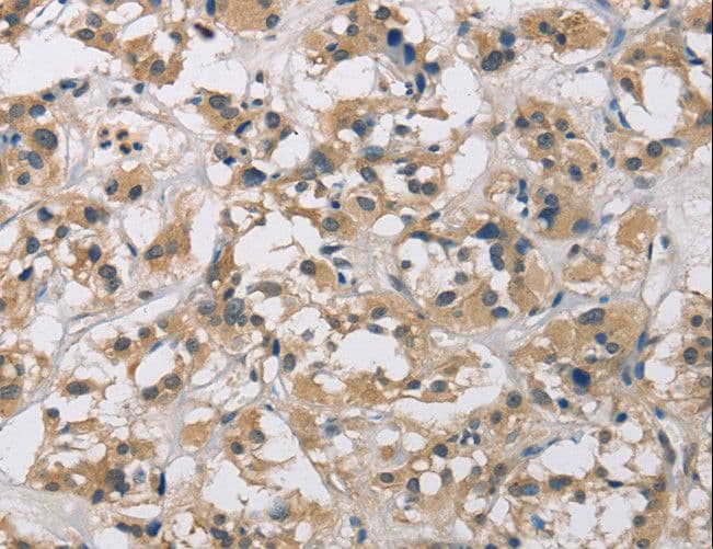CYR61 Antibody