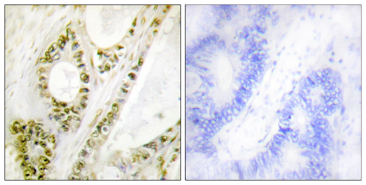 IRF3 Antibody (phospho-Ser385)