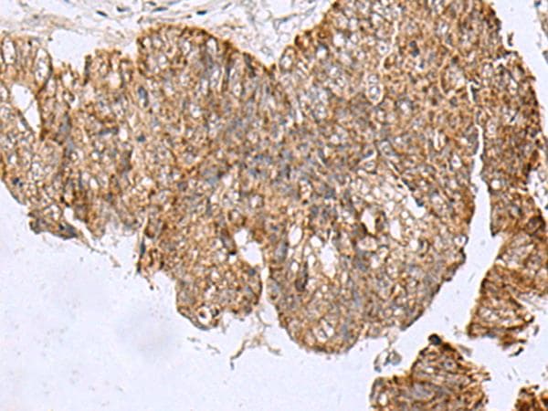 Polyclonal Rabbit anti-Human HCCS Antibody (IHC, WB)