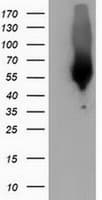 Monoclonal Mouse anti-Human CALCOCO2 Antibody (clone OTI2C11, IF, WB)