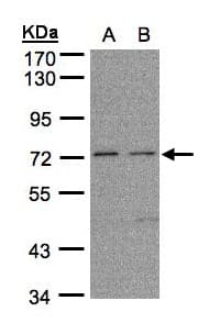 Polyclonal Rabbit anti-Human FLRT1 Antibody (aa35-255, IHC, WB)