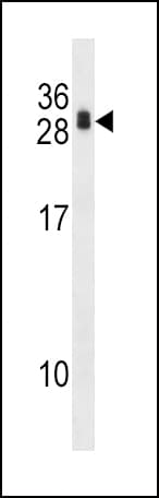 RCAN1 / DSCR1 Antibody (aa41-68)