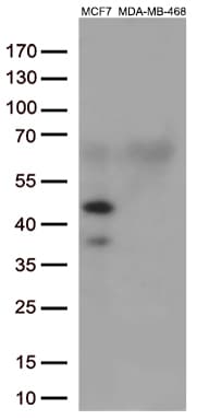 GATA3 Antibody (aa155-443, clone UMAB218)