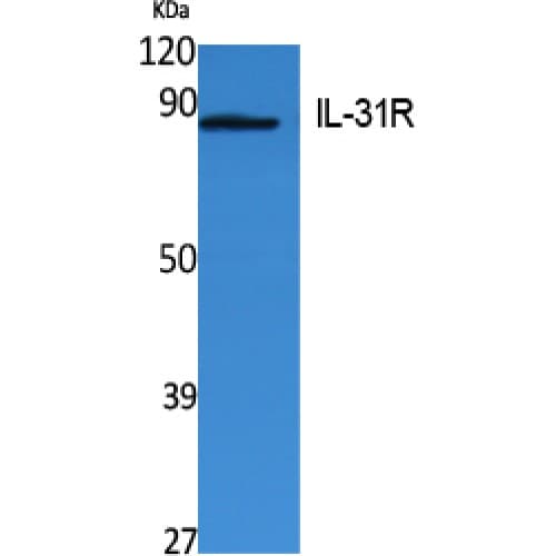 IL31RA Antibody (Internal)