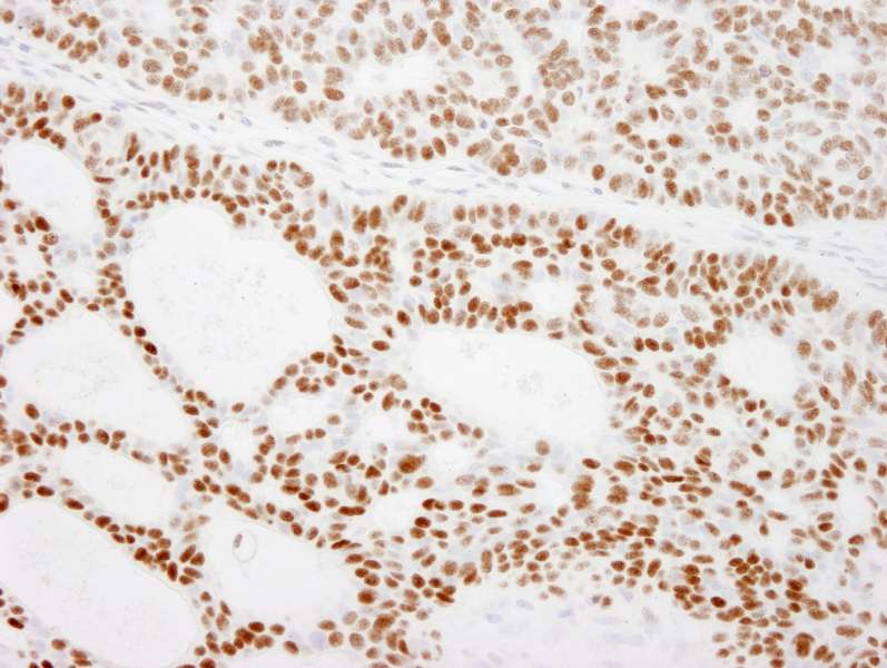 RCC2 Antibody (aa475-C-term)