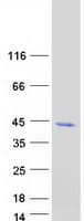 Human ADH6 Protein (Recombinant Myc-DDK (Flag))