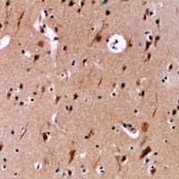 EIF1AX Antibody