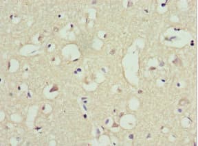 Polyclonal Rabbit anti-Human TRIM13 Antibody (IHC, WB)