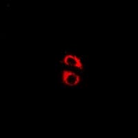 KCNJ11 / Kir6.2 Antibody