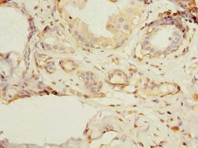 Polyclonal Rabbit anti-Human PSD4 Antibody (IHC)