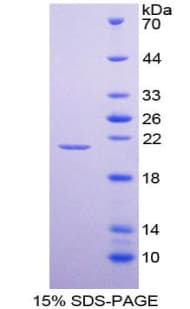 Mouse TNFRSF4 / CD134 / OX40 Protein (Recombinant His)