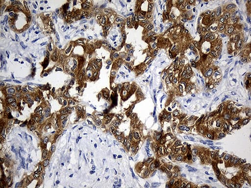 CIB1 / KIP Antibody (aa2-191, clone OTI1B8, Carrier-free)