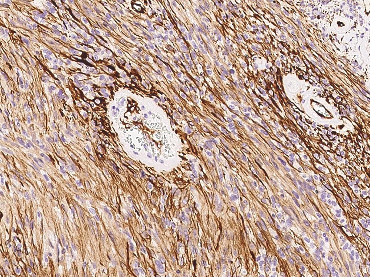 NES / Nestin Antibody (clone 11, Preservative Free)
