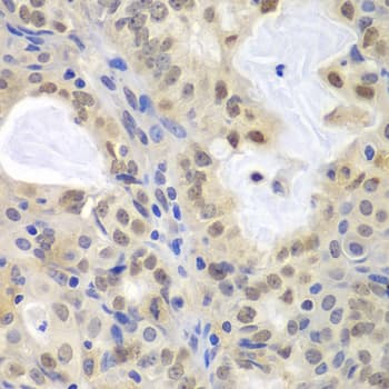 Polyclonal Rabbit anti-Human MCM3 Antibody (IHC, IF, WB)