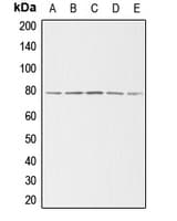 ADD3 Antibody (Internal)
