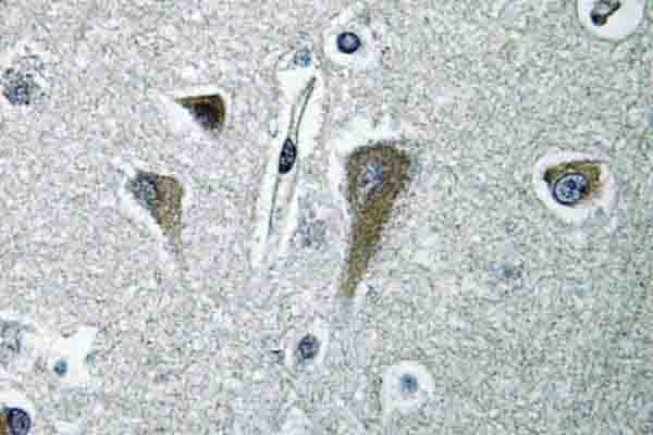 EIF5B / IF2 Antibody (His1086)