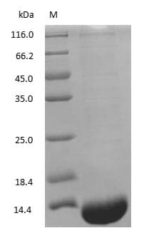 Hemoglobin Protein (Native)
