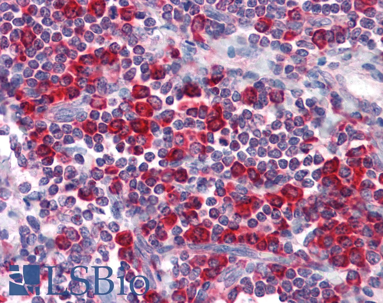 IHC-plus™ Monoclonal Mouse anti-Human MTDH / Metadherin Antibody (clone 2F11C3, IHC, WB)