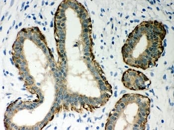 SERPINB5 / Maspin Antibody (aa1-350)