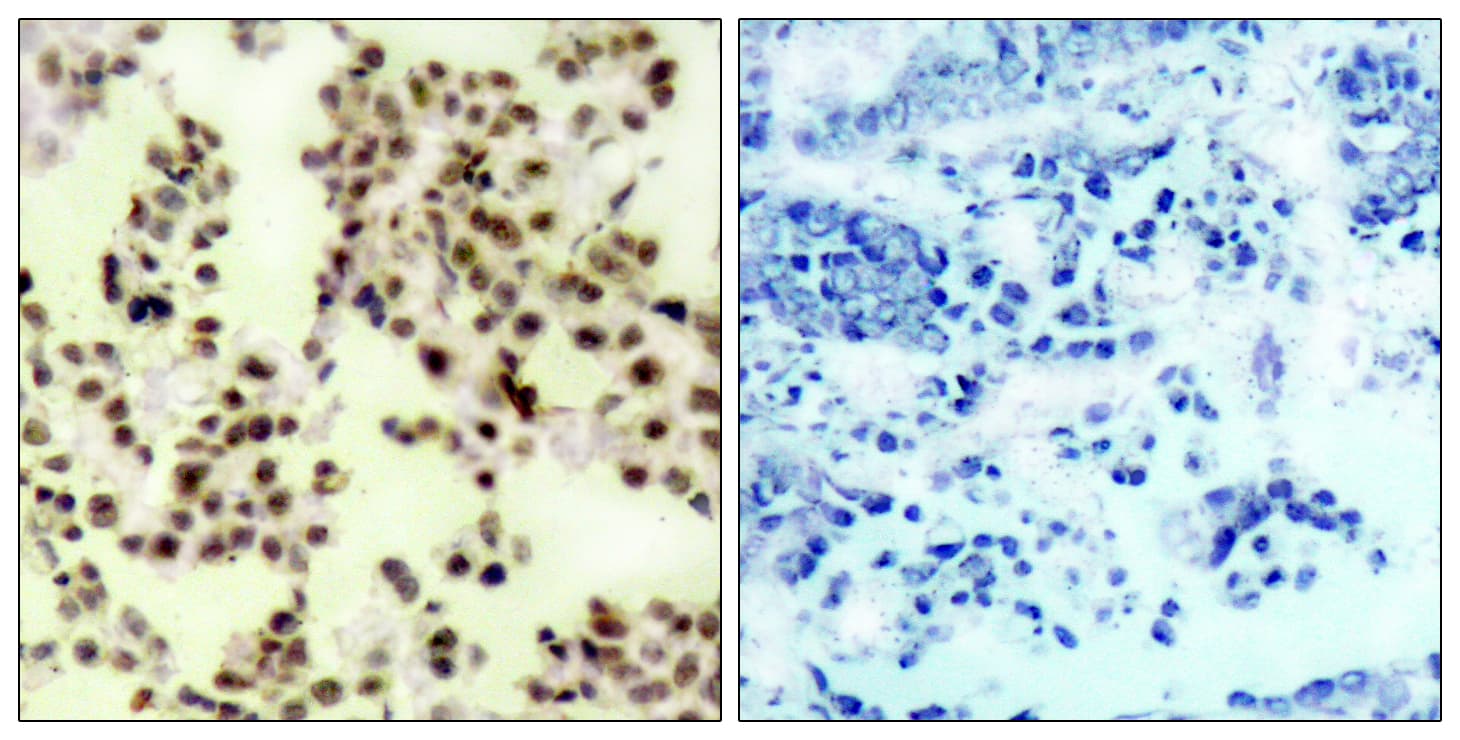 TP73 / p73 Antibody (phospho-Tyr99)
