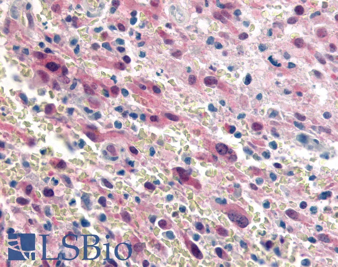 IHC-plus™ GPR17 Antibody (N-Terminus)