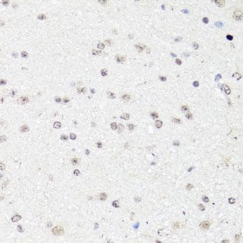 VEGFD Antibody