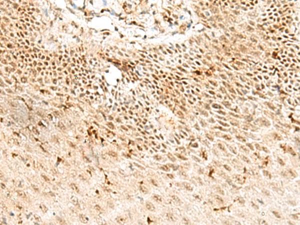 Polyclonal Rabbit anti-Human RBM10 Antibody (IHC)