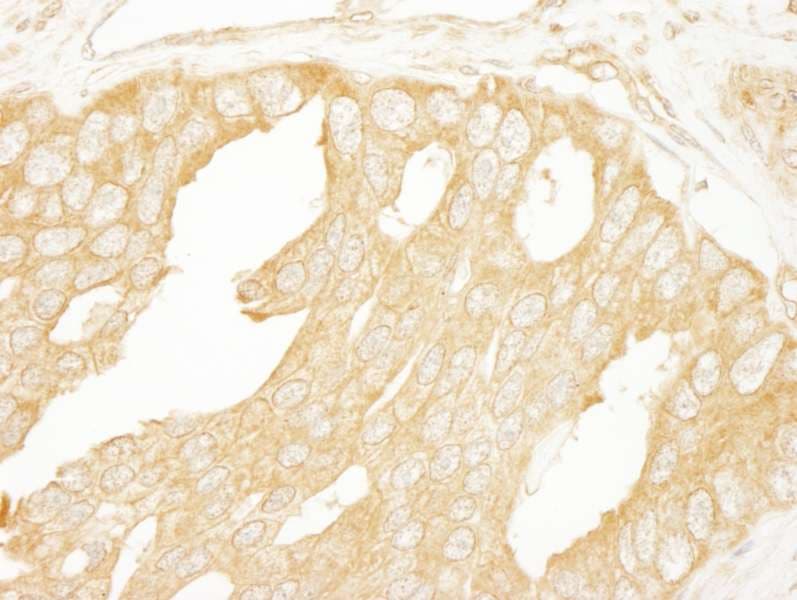 Polyclonal Rabbit anti-Human BRAF / B-Raf Antibody (aa25-75, IHC, WB)