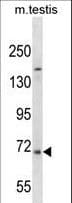 EXTL1 Antibody (aa649-676)