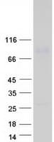 Human C1orf106 Protein (Recombinant Myc-DDK (Flag))