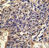 Polyclonal Rabbit anti-Human IL1A / IL-1 Alpha Antibody (aa177-206, IHC, WB)